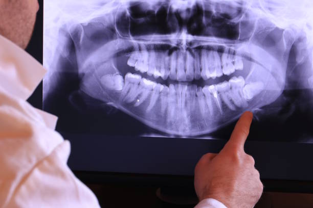 Best Emergency Dental Care for Broken or Chipped Teeth in Highlands, NC